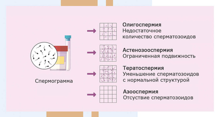Различные нарушения эякулята. Альтравита.