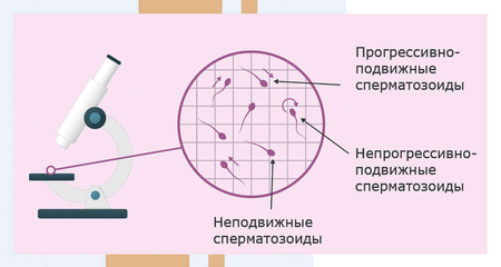Астенозооспермия. Альтравита.