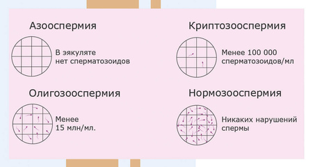 Азооспермия. Альтравита.