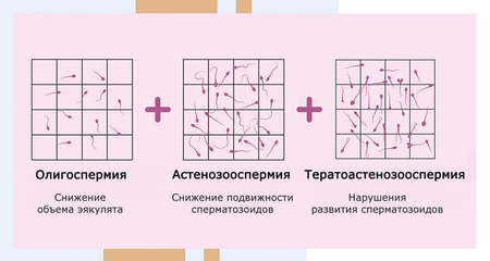 Олигоастенотератозооспермия. Альтравита.