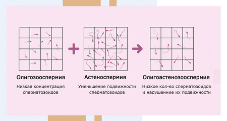 Олигоастенозооспермия. Альтравита.