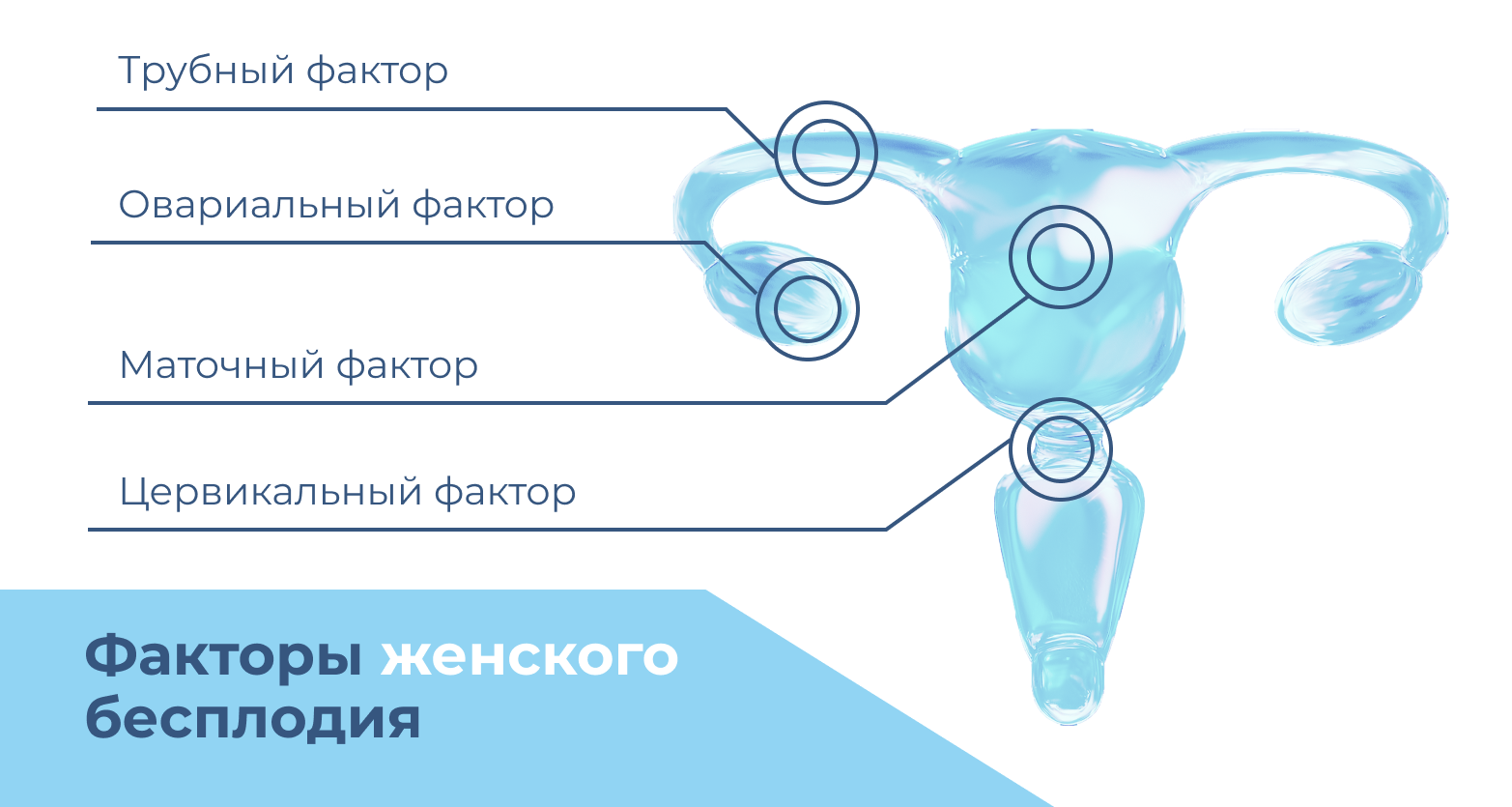 Основные причины бесплодия в парах - Изображение №1