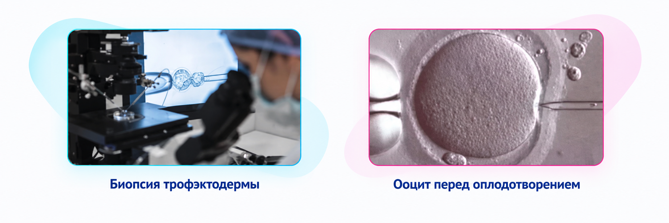HEPES-содержащие среды для работы вне инкубатора - Изображение №7