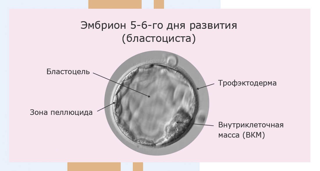 Эмбрион 5-6-го дня развития (бластоциста): бластоцель, зона пеллюцида, трофэктодерма, внутриклеточная масса