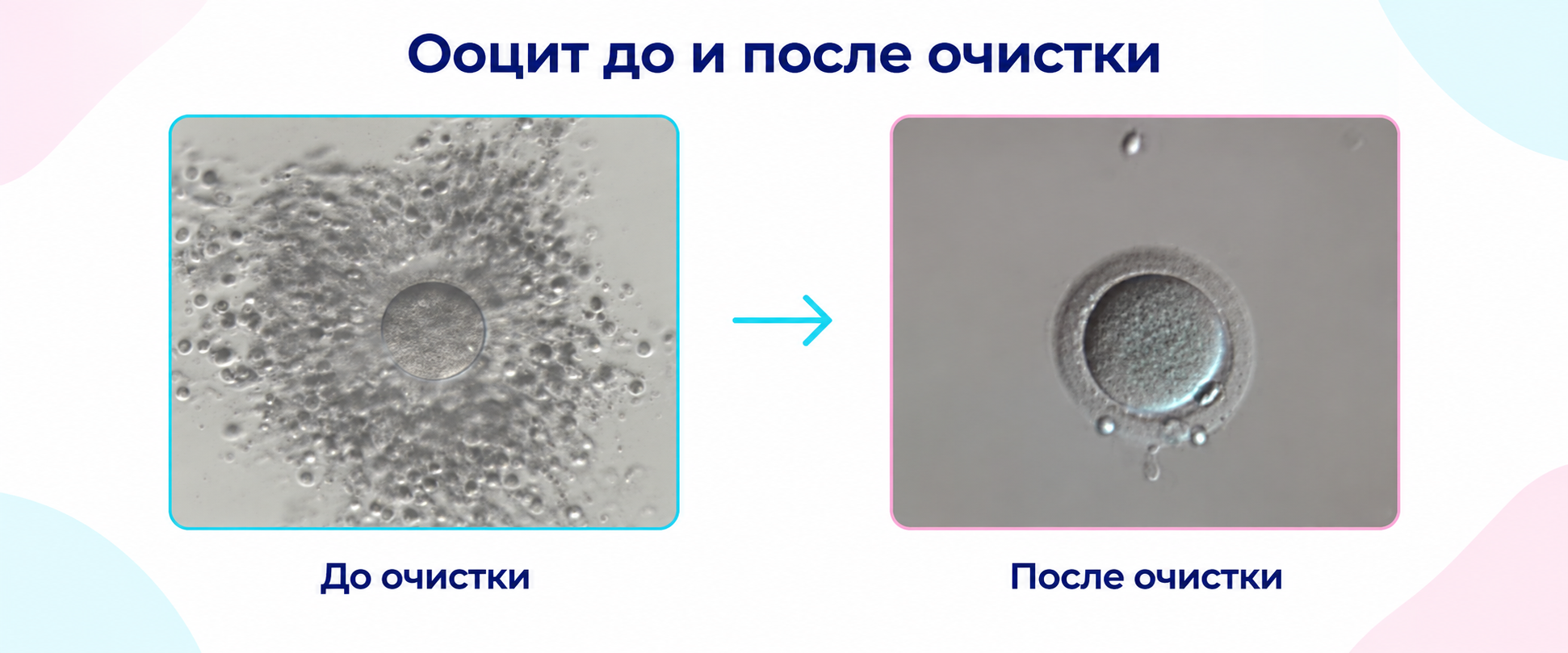 Ооцит до очистки от клеток кумулюса