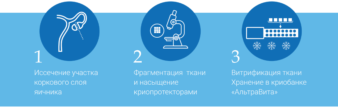 Этапы криоконсервации овариальной ткани