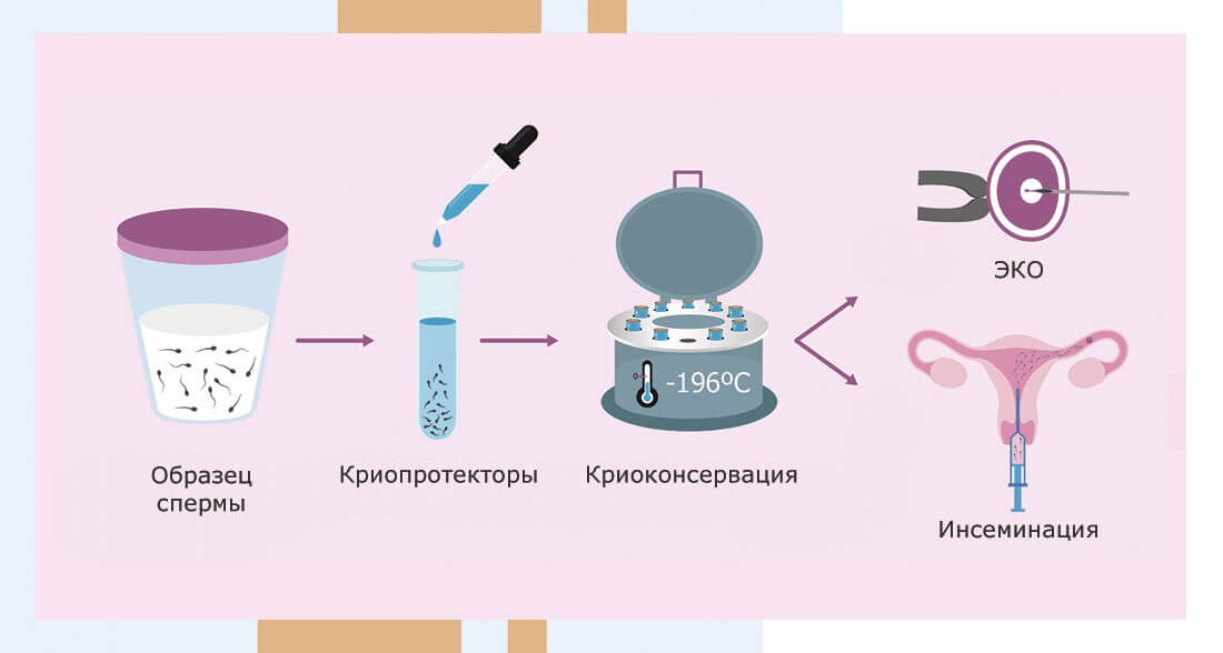Обработка и криоконсервация спермы